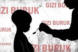 29 Ribu Balita di Kabupaten Garut Alami Stunting