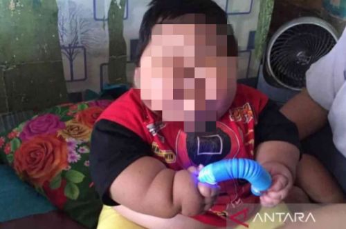 Balita obesitas Muhammad Kenzi Alfaro asal Kampung Tambun Permata, RT 002/002, Desa Pusaka Rakyat, Kecamatan Tarumajaya, Kabupaten Bekasi, Jawa Barat. (ANTARA/Pradita Kurniawan Syah).